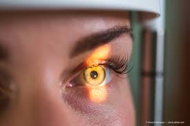 Air pollution may increase your risk of Glaucoma