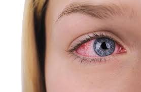 Uveitis and Scleritis patients more likely to develop age-related macular degeneration