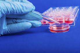 World's first iPS transplant of visual cells performed