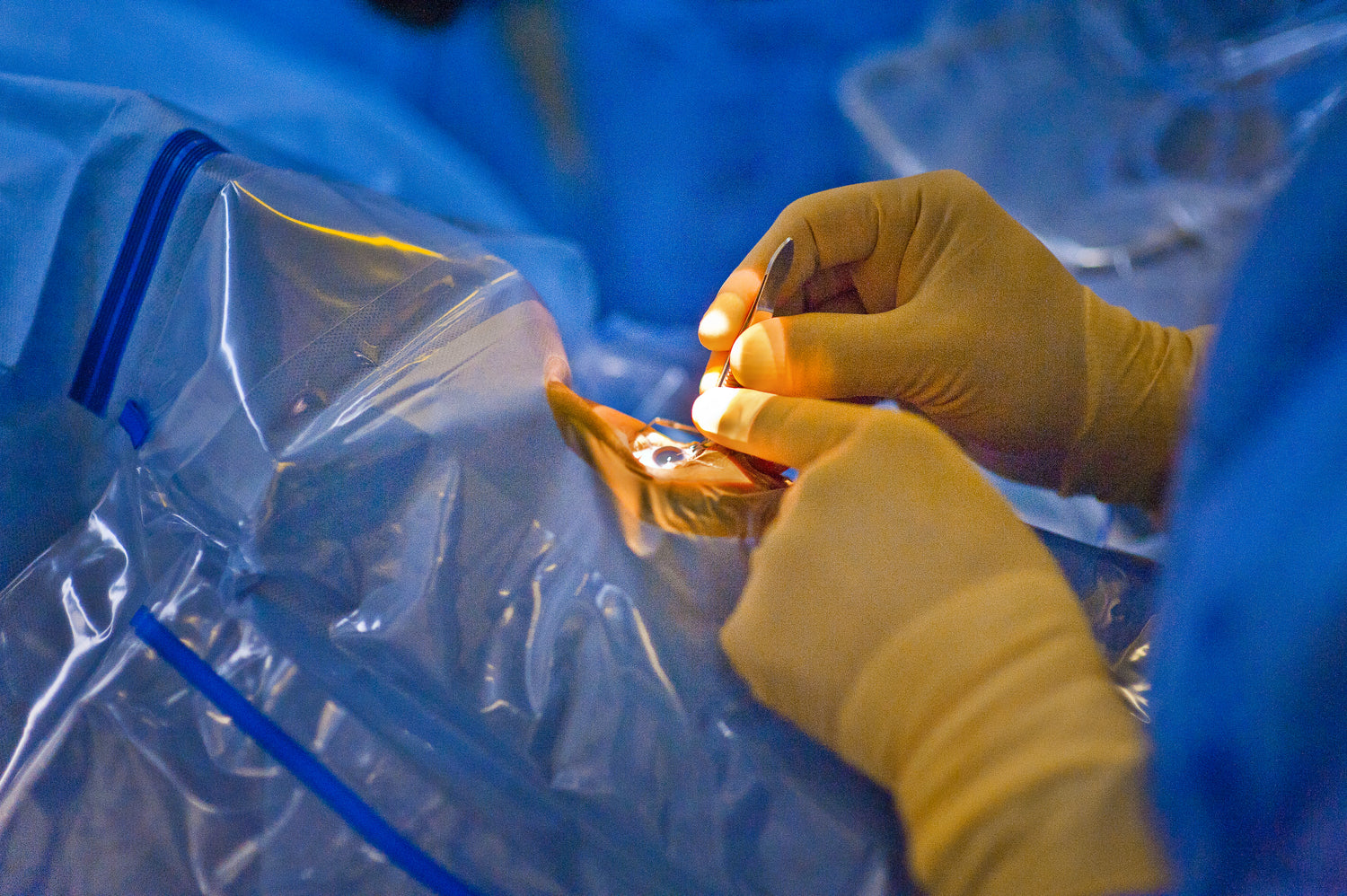 Patients prefer dropless regimen to drops after cataract surgery