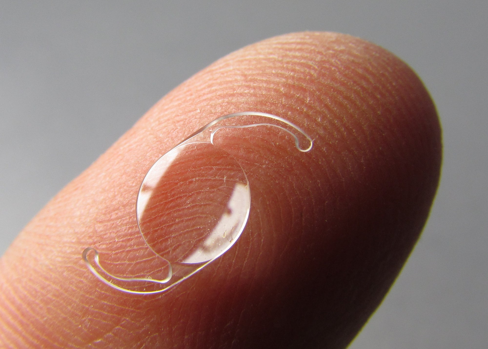 Cataract Surgery Intraocular Lens Choices