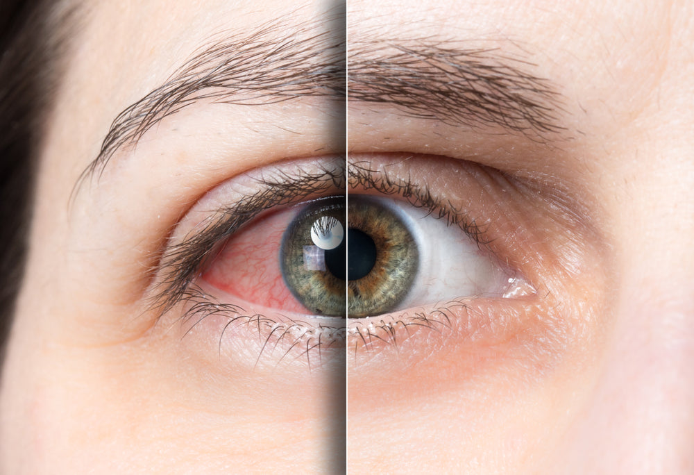 Contaminated eye drops continue to be a problem