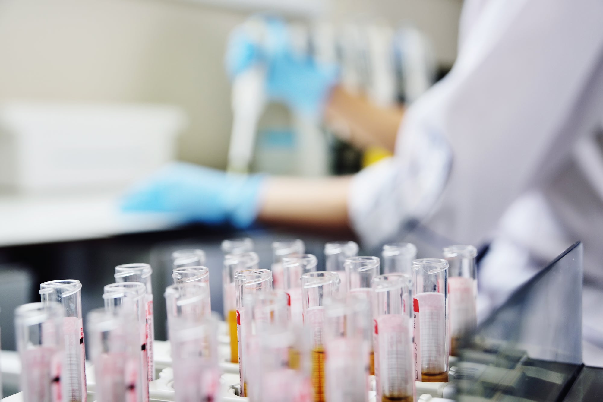 New genetic eye disease discovered