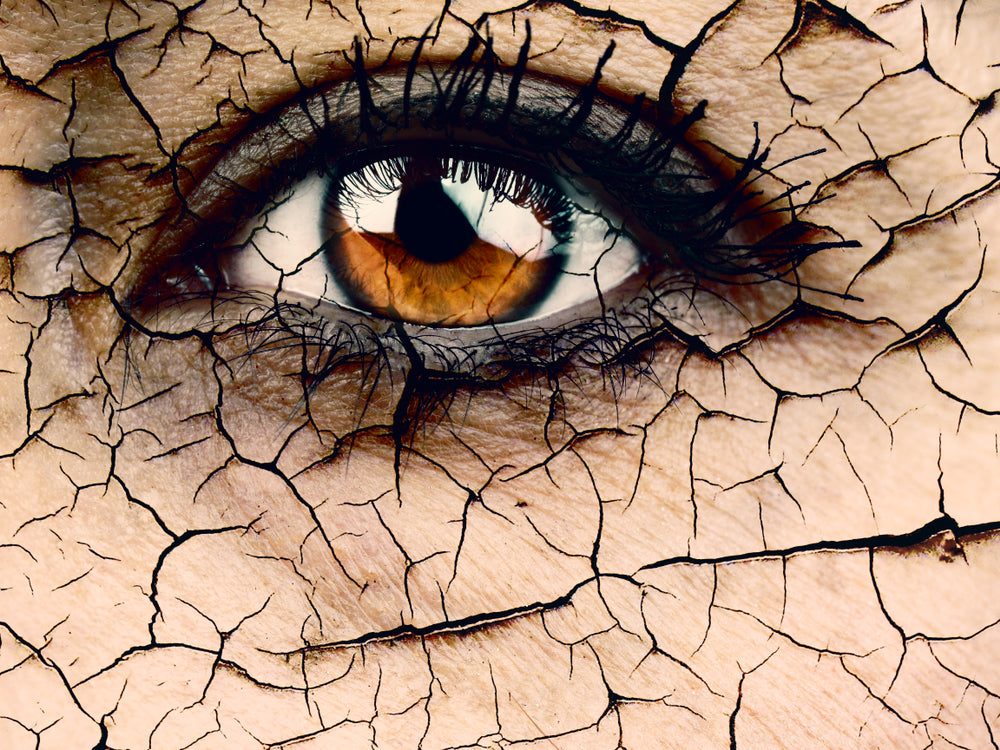 New cyclosporine drop for dry eye has advantages over current drops