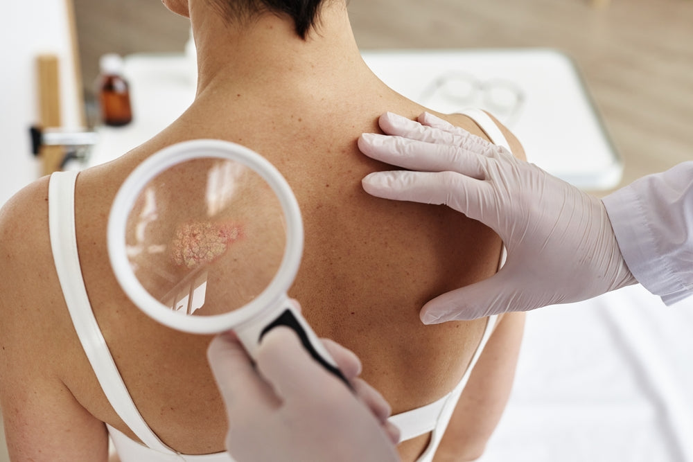 Diabetic retinopathy risk doubled for diabetic patients who have psoriasis