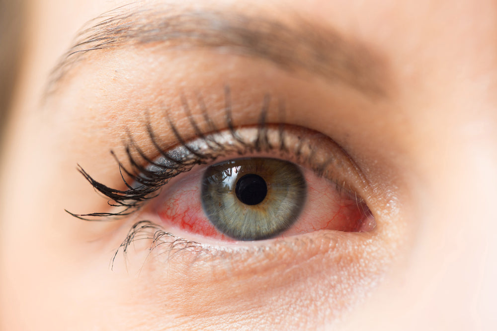 Dry Eye Awareness is observed the month of July